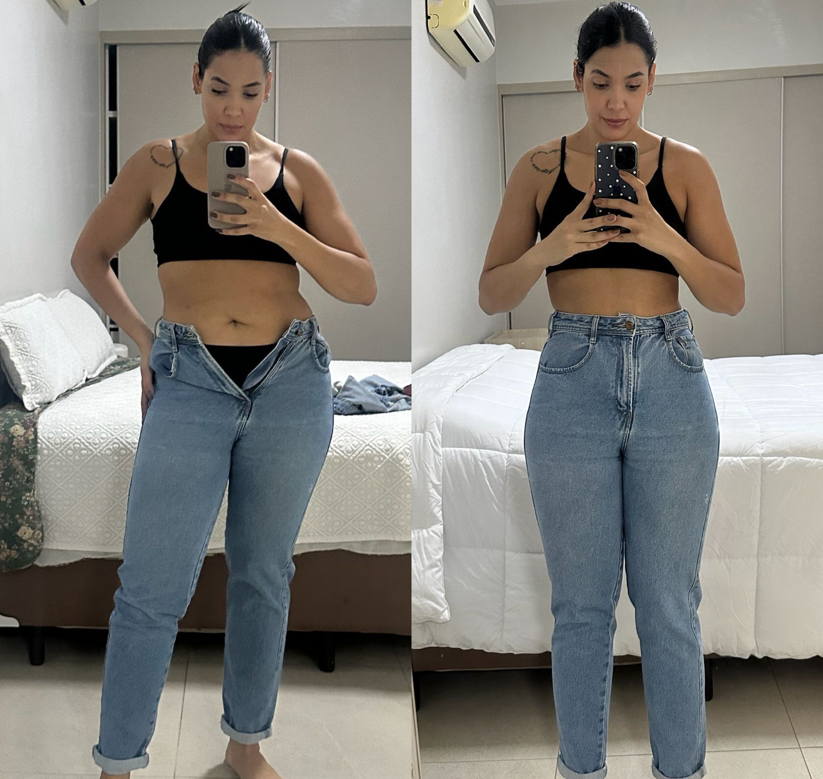 Resultado de paciente, antes e depois do tratamento